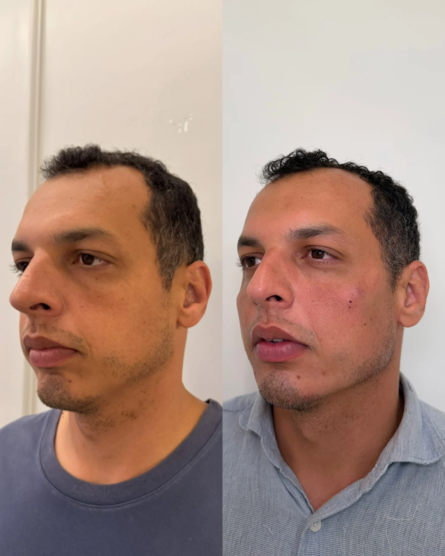 Comparação clínica autorizada completa de perfil e contorno facial